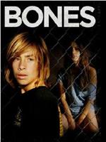 Bones